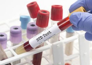 STD Screening Profiles: From Simple Checkups to Full Sexual Health Panels